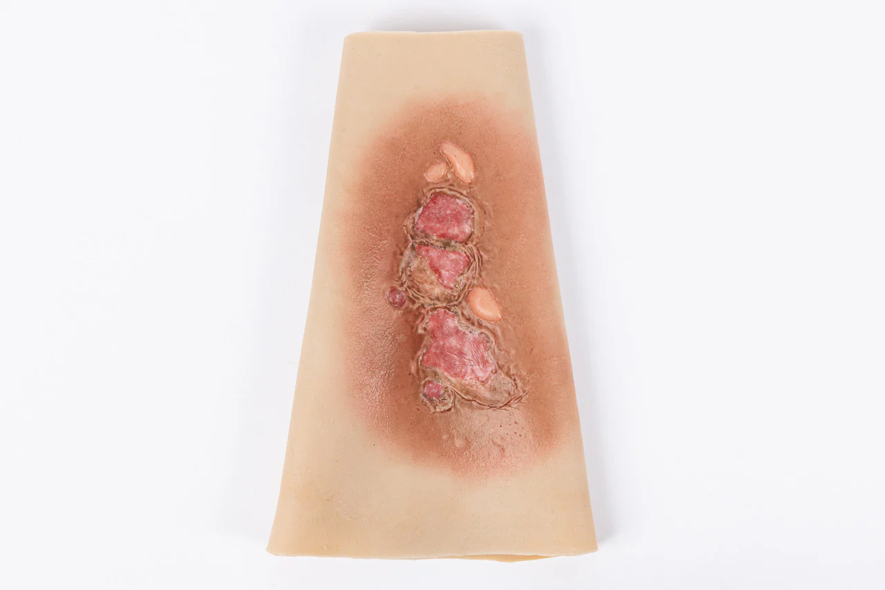 TRAUMASIM Wearable Small Burn - Forearm
